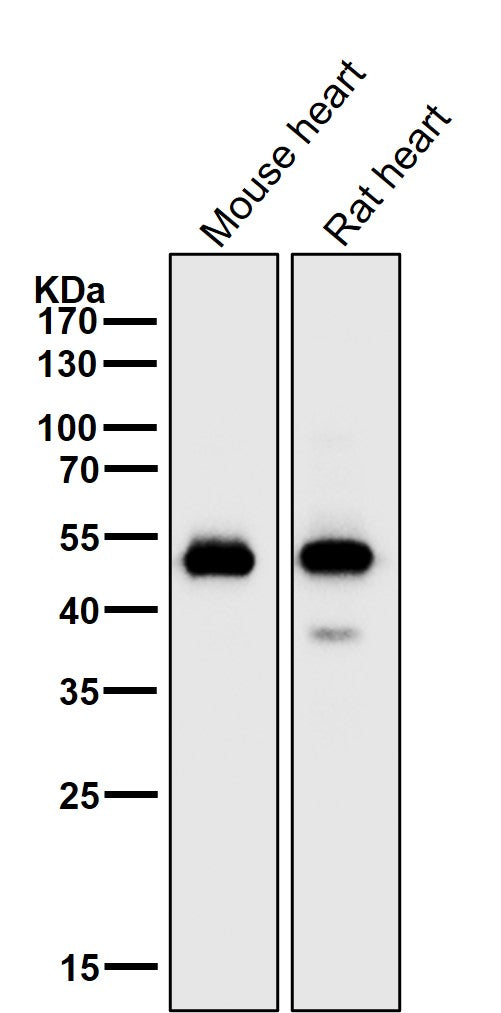 Anti-alpha Sarcoglycan Rabbit Monoclonal Antibody Boster Bio