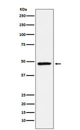 Anti-NR2E1 Rabbit Monoclonal Antibody Boster Bio