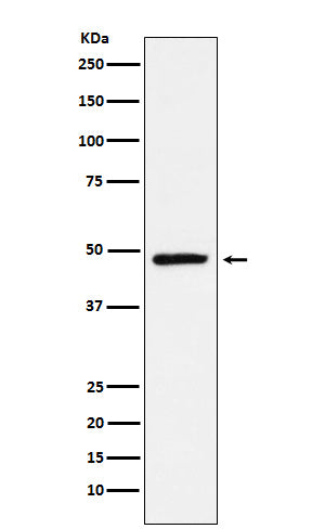 Anti-NR2E1 Rabbit Monoclonal Antibody Boster Bio