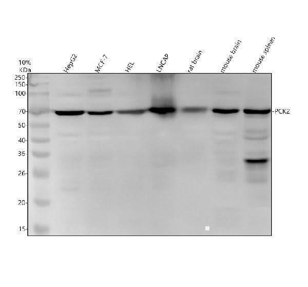 Anti-PCK2 Monoclonal Antibody Boster Bio
