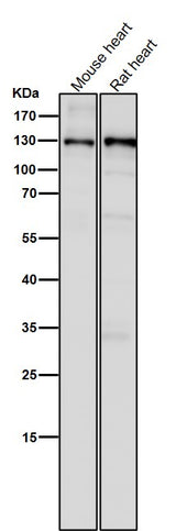 Anti-CC2D1A Rabbit Monoclonal Antibody Boster Bio