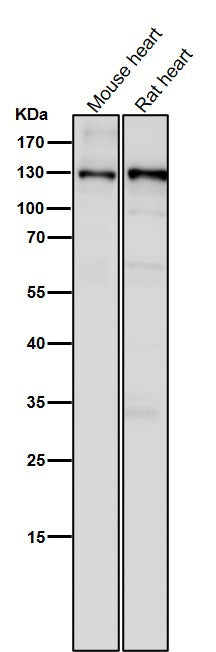 Anti-CC2D1A Rabbit Monoclonal Antibody Boster Bio