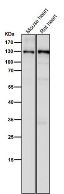 Anti-CC2D1A Rabbit Monoclonal Antibody Boster Bio