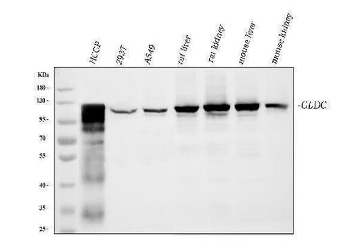 Anti-Glycine decarboxylase/GLDC Antibody Picoband® (monoclonal, 3D3D3 Boster Bio
