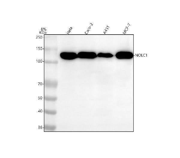Anti-NOLC1 Rabbit Monoclonal Antibody Boster Bio
