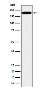 Anti-IQGAP2 Rabbit Monoclonal Antibody Boster Bio