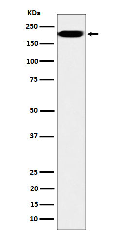 Anti-IQGAP2 Rabbit Monoclonal Antibody Boster Bio