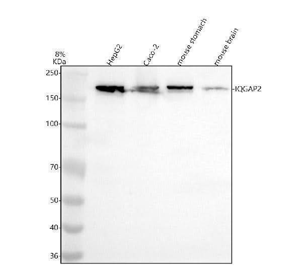 Anti-IQGAP2 Rabbit Monoclonal Antibody Boster Bio