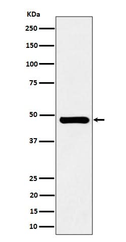 Anti-SNX5 Rabbit Monoclonal Antibody Boster Bio