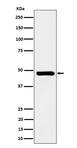 Anti-SNX5 Rabbit Monoclonal Antibody Boster Bio