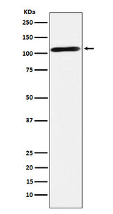 Anti-Epac2 Rabbit Monoclonal Antibody Boster Bio