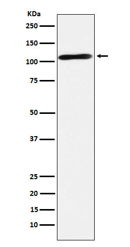 Anti-Epac2 Rabbit Monoclonal Antibody Boster Bio