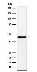 Anti-HLA F Rabbit Monoclonal Antibody Boster Bio