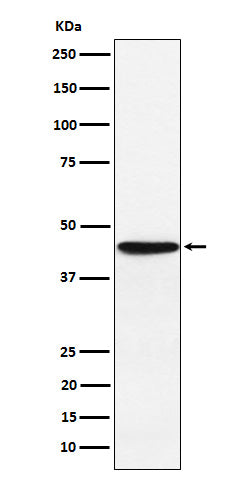 Anti-HLA F Rabbit Monoclonal Antibody Boster Bio
