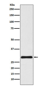Anti-VPS24 Rabbit Monoclonal Antibody Boster Bio