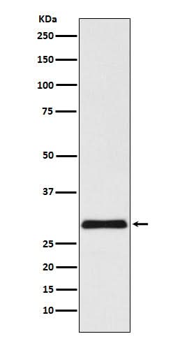 Anti-VPS24 Rabbit Monoclonal Antibody Boster Bio