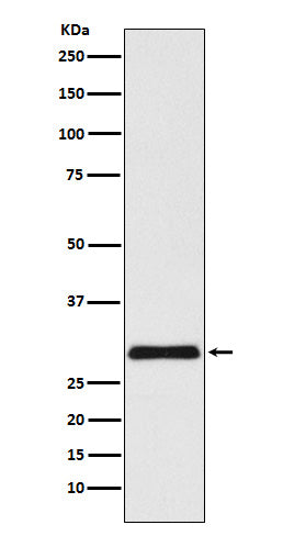 Anti-VPS24 Rabbit Monoclonal Antibody Boster Bio
