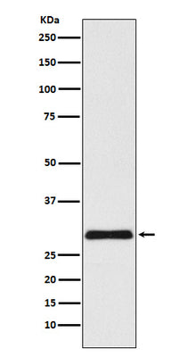 Anti-VPS24 Rabbit Monoclonal Antibody Boster Bio