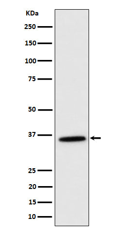 Anti-MDH2 Rabbit Monoclonal Antibody Boster Bio