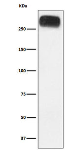 Anti-mGluR3 Rabbit Monoclonal Antibody Boster Bio