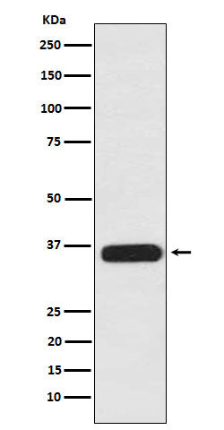 Anti-PDLIM1 Rabbit Monoclonal Antibody Boster Bio