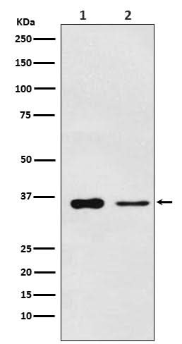 Anti-PDLIM1 Rabbit Monoclonal Antibody Boster Bio