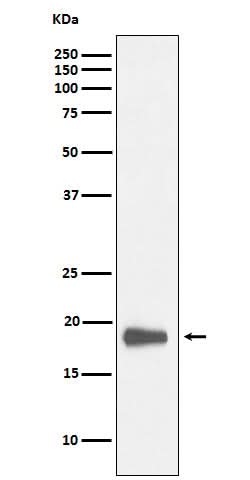 Anti-HMGN2 Rabbit Monoclonal Antibody Boster Bio