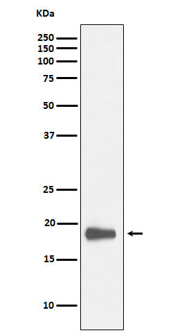 Anti-HMGN2 Rabbit Monoclonal Antibody Boster Bio