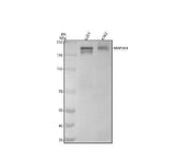 Anti-MAP3K4 Rabbit Monoclonal Antibody Boster Bio