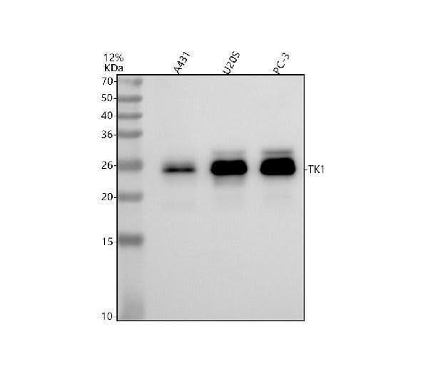 Anti-Thymidine Kinase 1 Rabbit Monoclonal Antibody Boster Bio