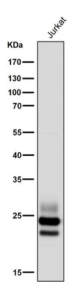Anti-CD3G Rabbit Monoclonal Antibody Boster Bio