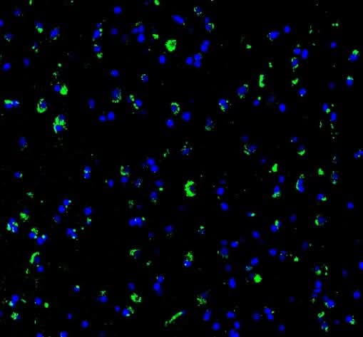 Anti-SynGAP Rabbit Monoclonal Antibody Boster Bio
