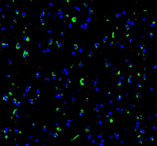 Anti-SynGAP Rabbit Monoclonal Antibody Boster Bio