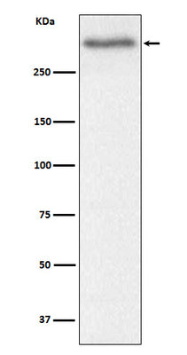 Anti-Versican Rabbit Monoclonal Antibody Boster Bio