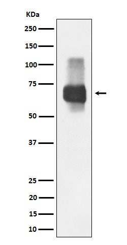 Anti-CD84 Rabbit Monoclonal Antibody Boster Bio