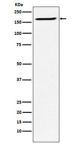 Anti-SMC4 Rabbit Monoclonal Antibody Boster Bio
