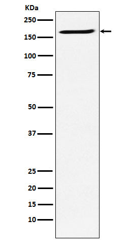 Anti-SMC4 Rabbit Monoclonal Antibody Boster Bio