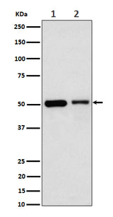 Anti-Annexin A7 Rabbit Monoclonal Antibody Boster Bio