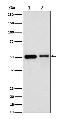 Anti-Annexin A7 Rabbit Monoclonal Antibody Boster Bio
