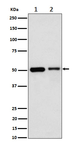 Anti-Annexin A7 Rabbit Monoclonal Antibody Boster Bio