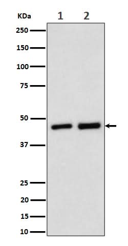 Anti-Annexin A7 Rabbit Monoclonal Antibody Boster Bio