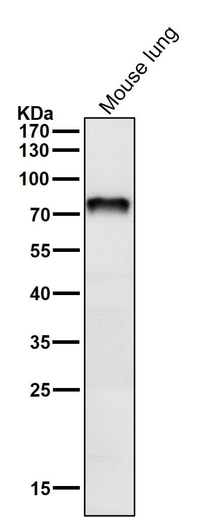 Anti-Netrin 1 NTN1 Monoclonal Antibody Boster Bio