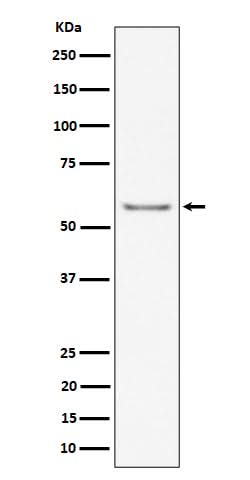 Anti-ICAM2 / CD102 Rabbit Monoclonal Antibody Boster Bio