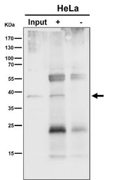 Anti-NSDHL Rabbit Monoclonal Antibody Boster Bio