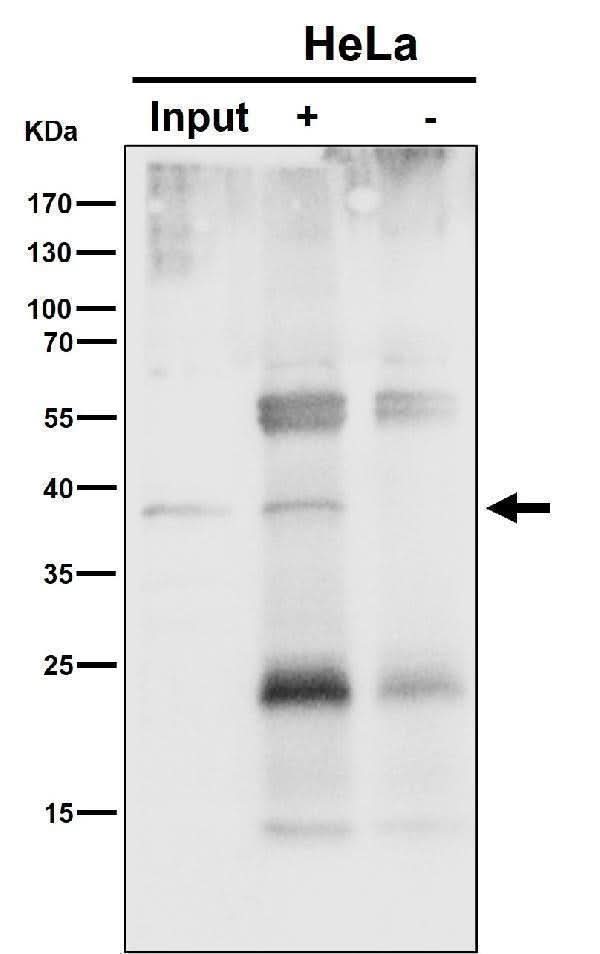 Anti-NSDHL Rabbit Monoclonal Antibody Boster Bio