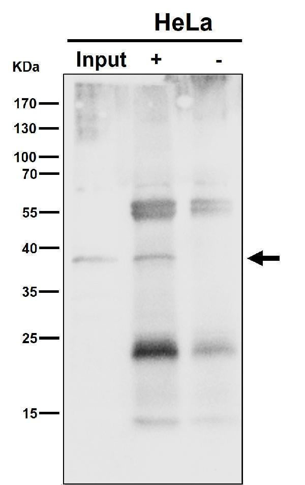 Anti-NSDHL Rabbit Monoclonal Antibody Boster Bio