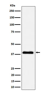 Anti-NSDHL Rabbit Monoclonal Antibody Boster Bio