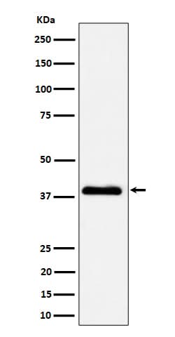 Anti-NSDHL Rabbit Monoclonal Antibody Boster Bio