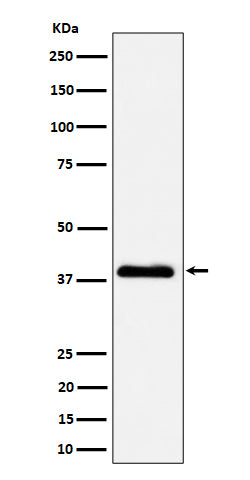 Anti-NSDHL Rabbit Monoclonal Antibody Boster Bio