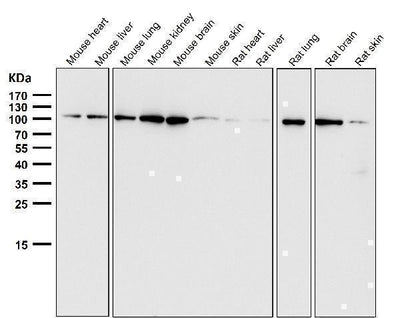 Anti-EXOC2 Rabbit Monoclonal Antibody Boster Bio